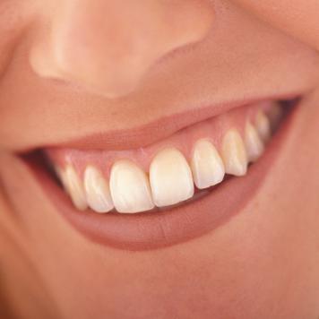 Denti bianchi