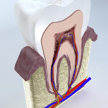 Dentina
