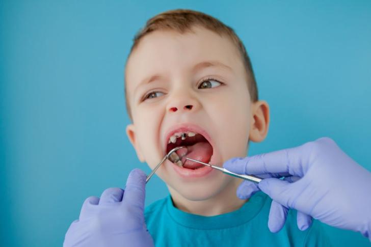 Denti marci bambini