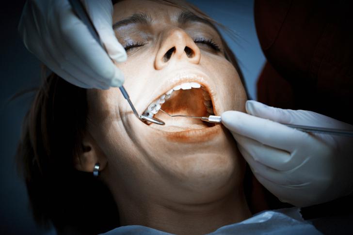 Amalgama dentale