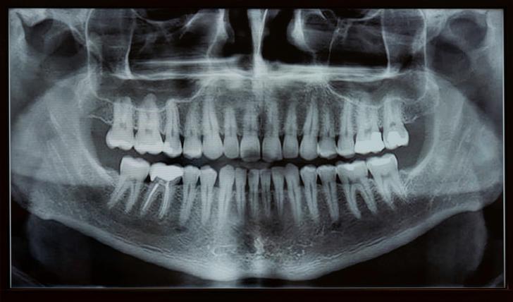 Anatomia bocca