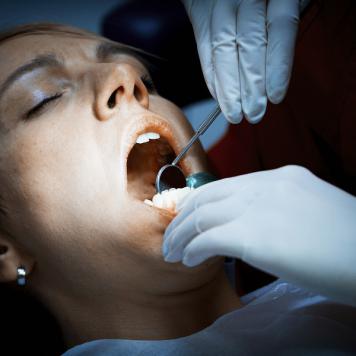Amalgama dentale