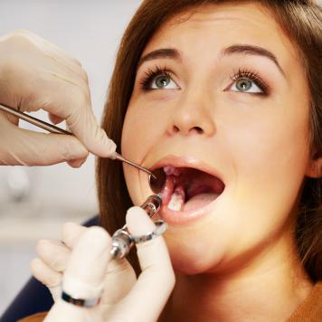 Anestesia dentista labbro storto