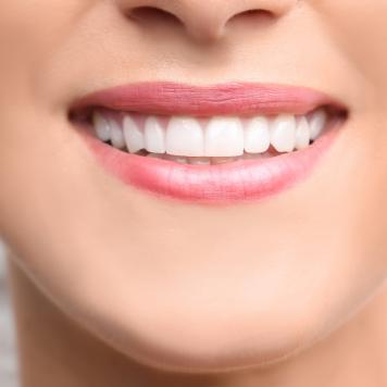 Bonding dentale