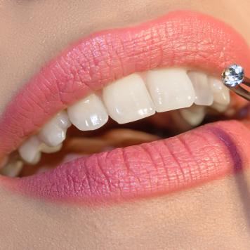Brillantino al dente costo il prezzo medio