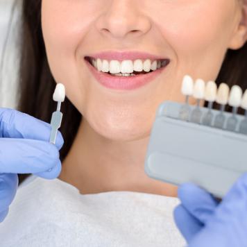Colore denti