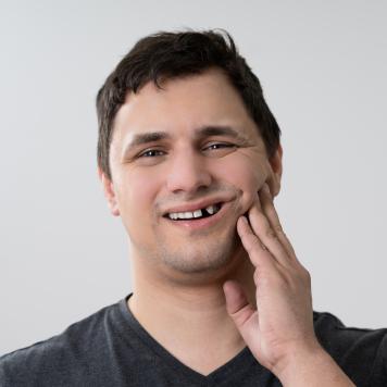 Come nascondere un dente rotto