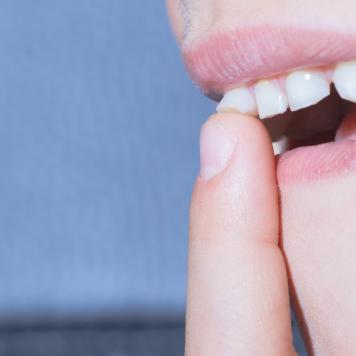 Dente da latte dondola ma non cade