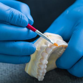 Dente finto incollato