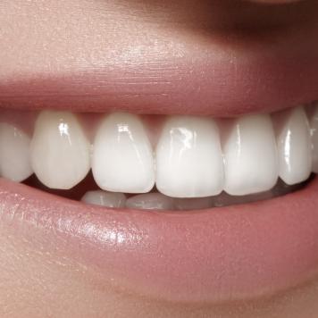 Denti perfetti