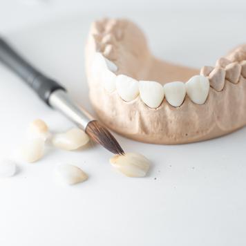 Denti rifatti prezzo