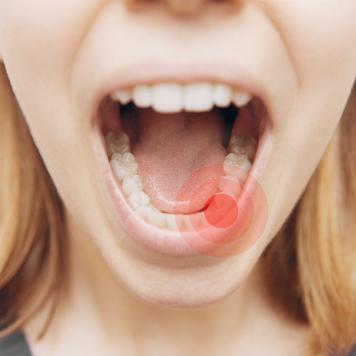 Estrazione dente con granuloma fa male