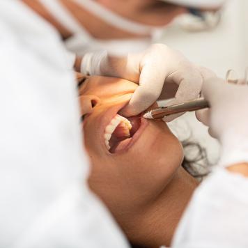 Estrazione dente con infezione sotto