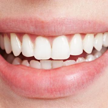 I denti sono ossa