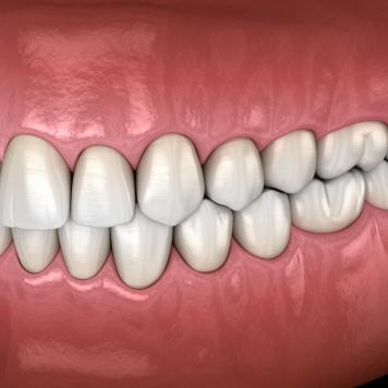Numerazione denti