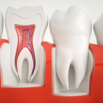 Polpa dentale