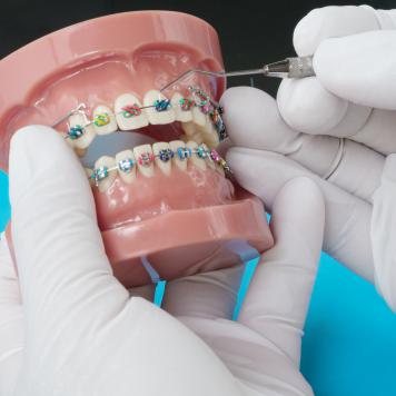Silicone ortodontico
