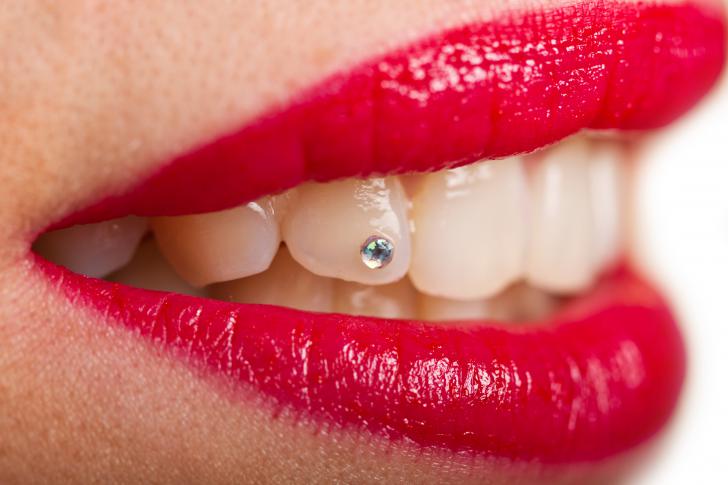 Brillantino al dente