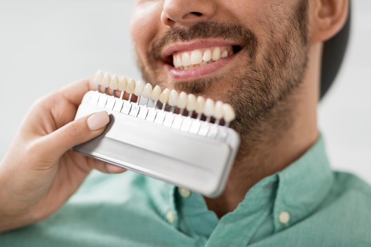 Colore denti