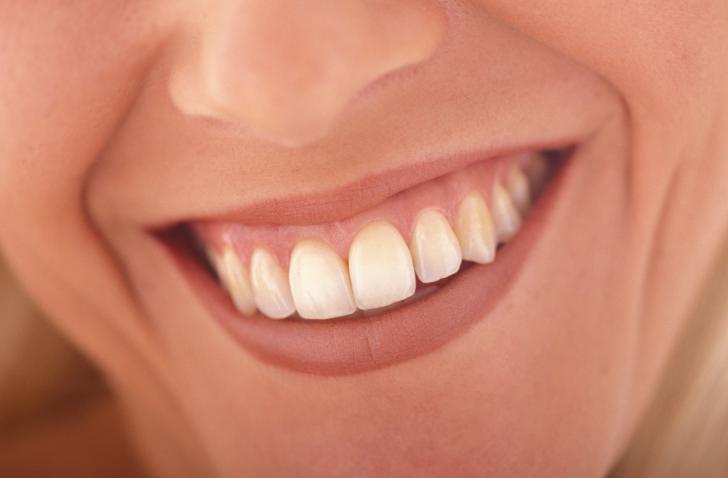 Di cosa sono fatti i denti