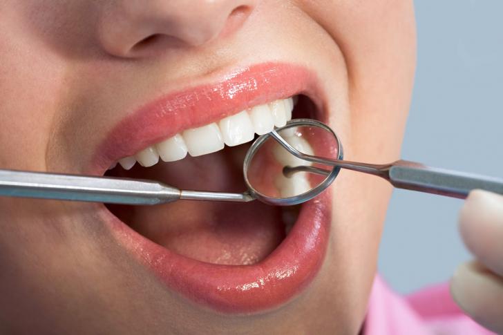 Interruzione trattamento ortodontico