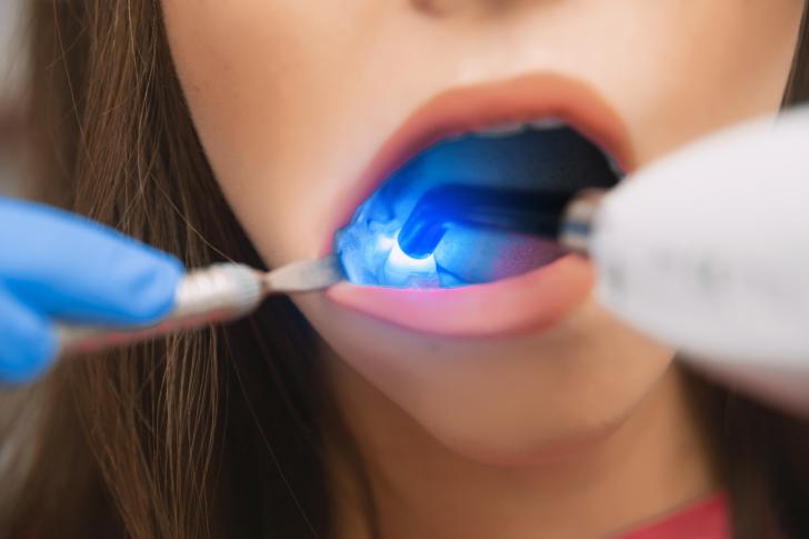 Laser parodontite controindicazioni
