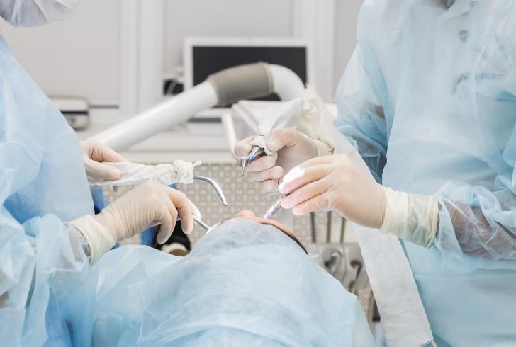 Pinze estrazione denti