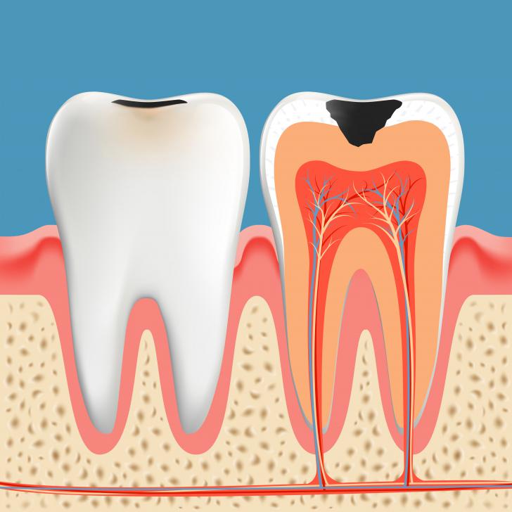 Polpa dentale