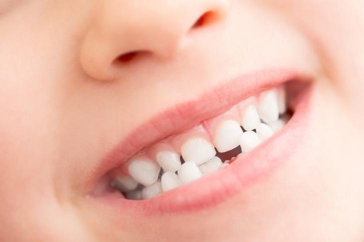 Quali sono i denti da latte
