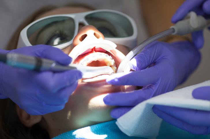 Ricostruzione gengivale laser