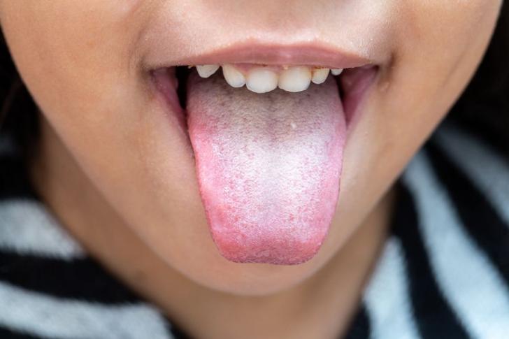 Saliva