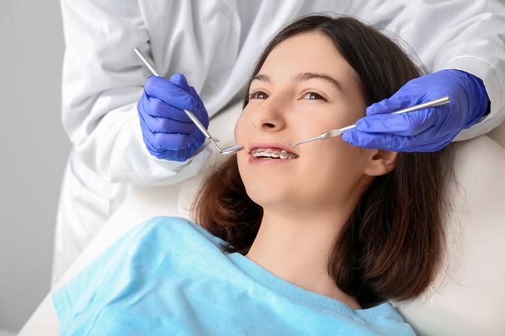 Silicone ortodontico