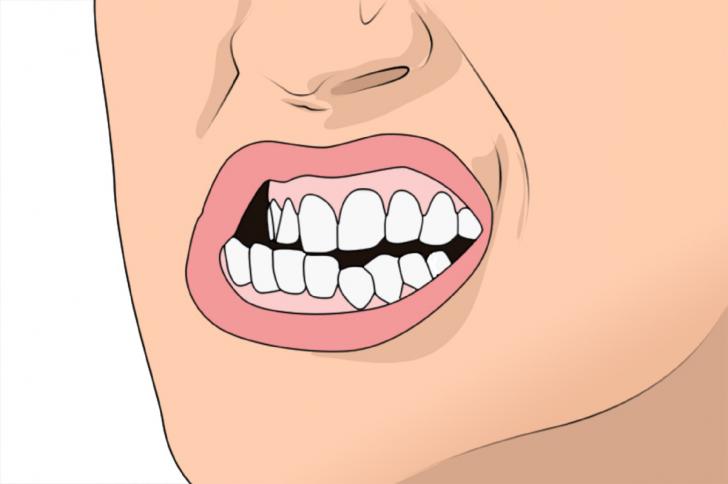 Digrignare i denti