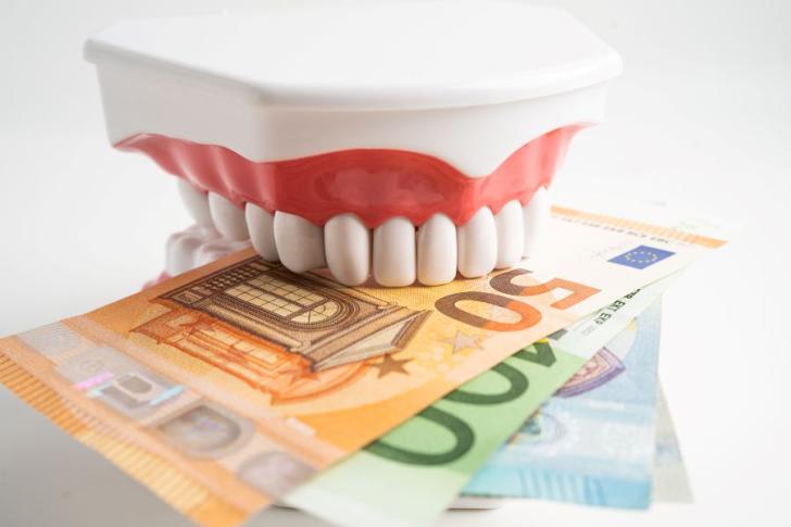 Costo impianto dentale forum